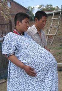孕妇怀孕4个月肚大 如球 , 医生说出检查结果后, 全家人喜忧参半