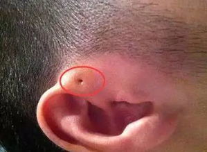 耳朵是怎么进化出来的(耳朵是如何形成的)