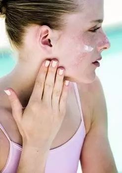换季皮肤过敏怎么办 你知道怎么预防和紧急处理吗 