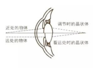 孩子近视查视力为什么都要散瞳