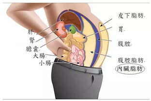 内脏脂肪型肥胖是怎么回事