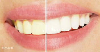 牙齿怎么都刷不白 影响牙黄的因素有哪些