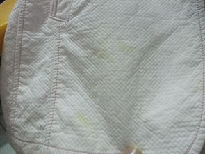 白色外套上面染有淡黄色的污渍用什么可以去掉 