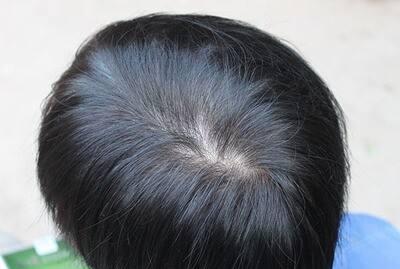 经常染发对身体有坏处吗 一年中,染发的频率是多少