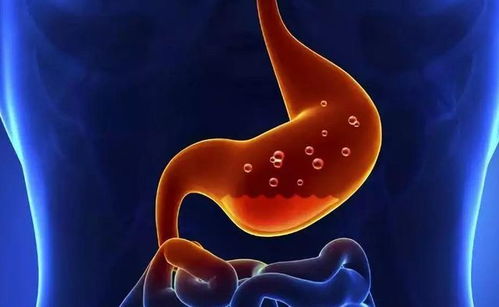 慢性胃炎不能吃什么食物,慢性胃炎简介