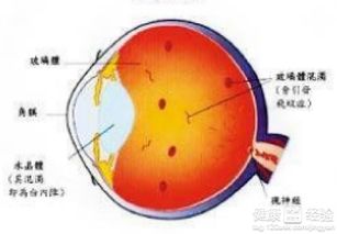角膜炎会不会引起飞蚊症