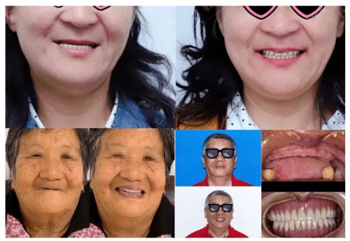 6月起,身份证42开头恭喜了 款已划拨,12 80岁缺牙 难看牙市民人人有份