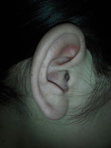 这是什么耳朵 