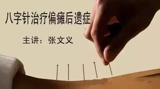 北京5.5日中风偏瘫久治不愈 八字针法让患者一针能动