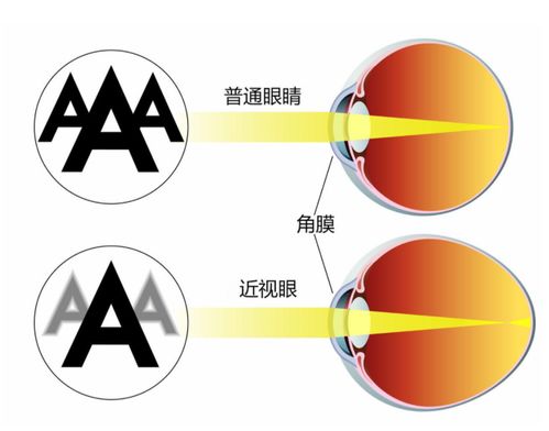 2020年双十二护眼神器是什么 这款投影仪一定不能少