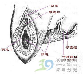 曝光阴道冲洗全过程 39健康网 