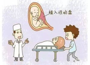 分娩全过程(生孩子流程)