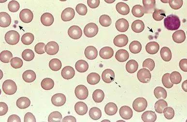 什么是正常的中性红细胞绝对值？