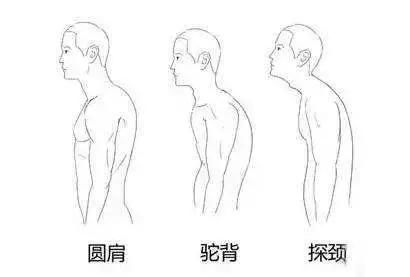 这3个体态问题不纠正,真的会显胖又显丑