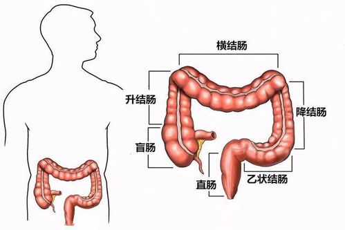 年年体检,为何还没能揪出肠癌 肛肠科医生透露4个原因