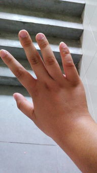 我14 女 我的手不好看 又不长 看到有些女生的手那么漂亮我心都碎啦 手指怎么才能变修长呢 