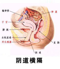 阴道横隔 文章列表 快速问医生 