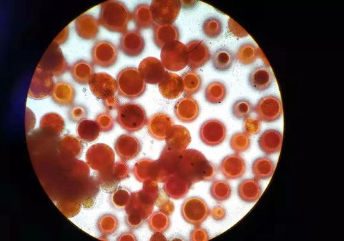 认识雨生红球藻 虾青素的强大营养功能