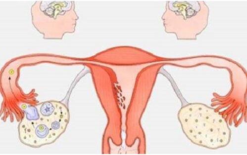 卵巢发育不全影响试管治疗吗，有希望怀孕吗？