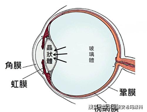 探究红外眼底成像的原理和应用