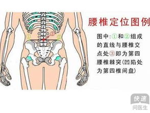 腰肩盘突出？腰肩盘突出有解决办法吗