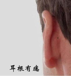 搜狐公众平台 耳朵上长痣,有什么寓意 