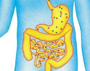 良性胃溃疡会癌变吗 胃溃疡久治不愈的原因是什么