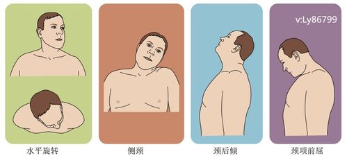 针灸按摩对 痉挛性斜颈 到底有没有用 医生道出了真相