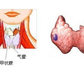 内分泌科百科 内分泌科医学疾病文章列表,第167页 快速问医生 