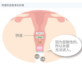 妇科阴道炎小知识