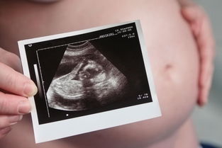 怀孕再做阴道超声会导致宝宝流产，是真的吗