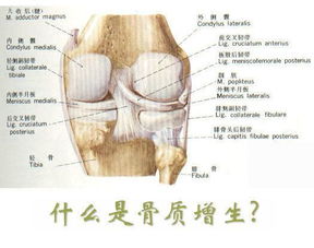 中医解说骨质增生 偏方疗法,用一个好一个 