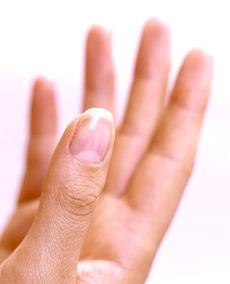 手指甲有白点是缺什么 指甲里的小白点是什么？ 