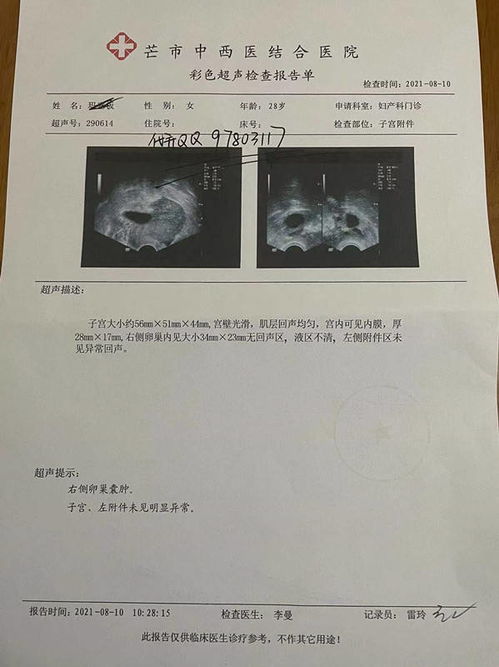 验孕一个月B超 早孕血HCG和B超单,早期中期B超图哪种早孕检测更准确