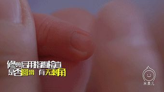 新生宝宝自己抓破脸 是否应该给新生儿剪指甲