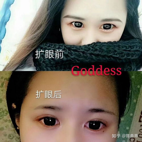 Goddess扩眼精油真的很好用 