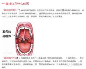 宝宝扁桃体发炎发烧39，给他吃了小儿氨酚黄那敏颗粒也没退烧啊，怎么办