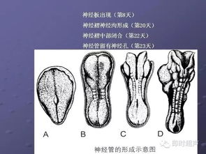 胎儿中枢神经系统畸形的超声诊断