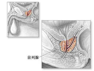 前列腺保险有必要买吗前列腺可报中国平安平安福
