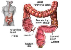 中医结肠肿瘤治疗医院