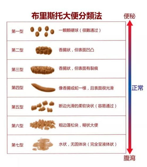 屎币的来历,从网络段子到真正的加密货币 屎币的来历,从网络段子到真正的加密货币 NTF