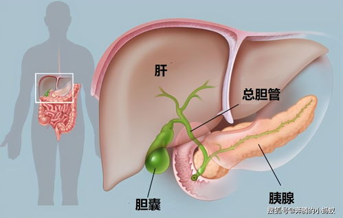 体检时一定要注意这一数据,胆囊息肉超过这个大小恶变率高