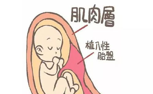 怀孕后发现有胎盘植入的我现在是快4个月了