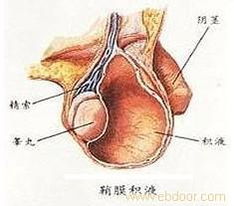 鞘膜积液非手术治疗方法 鞘膜积液非手术治疗方法高清大图 鞘膜积液非手术治疗方法高清图片 