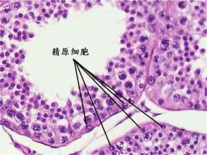 老师说精原细胞减速分裂后产生四个两种精子，好像不止吧，中间不是还有联会片段交换的现象吗？谁解释下？