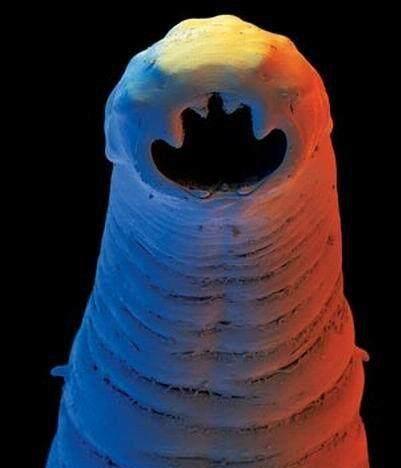 寄生人体肠道的线虫中体型最大者为,介绍。