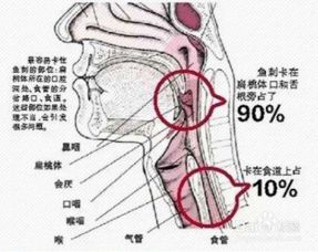 喉咙有异物感是什么原因 