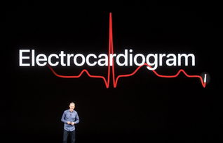 一名心脏专家的说法 用 Apple Watch 监测心颤没有意义
