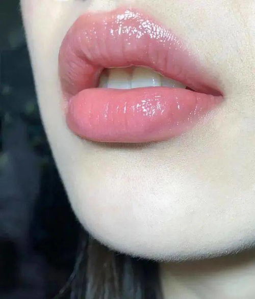 为什么嘴唇经常起皮,还越来越紫 可能是这几个原因造成