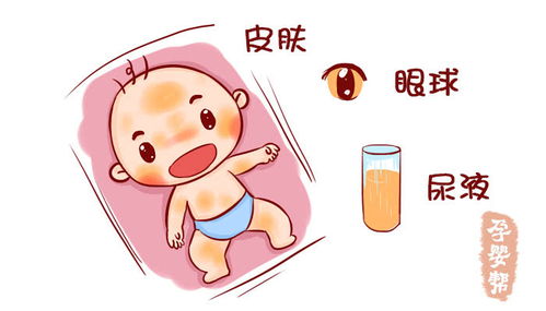 新生儿黄疸需要换血么,新生儿溶血性黄疸一定要换血吗？